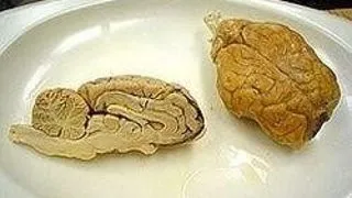 METODE DE A-TI MENTINE CREIERUL IN FORMA