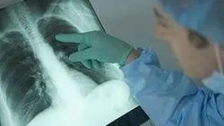 MISTER MEDICAL ? INFLAMATIE FATALA INSA FARA SEMNE DE INFECTIE