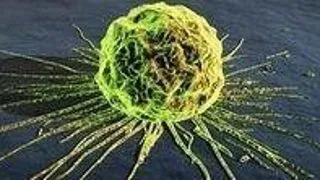 Top 6 conceptii gresite despre cancer