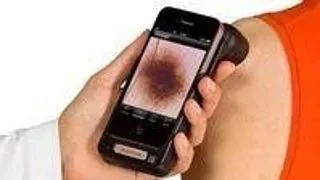 Telefoanele smartphone, folosite pentru diagnosticarea cancerului