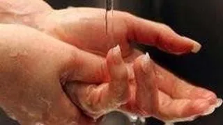 Rehabilitation of the Hand