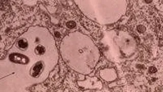 Temperature Effects in Soil Microbial Ecology