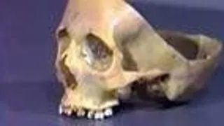 Human Anatomy Dissection