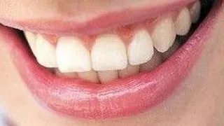 Cat te costa un implant dentar