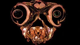 5 lucruri normale care devin filme horror sub microscop!