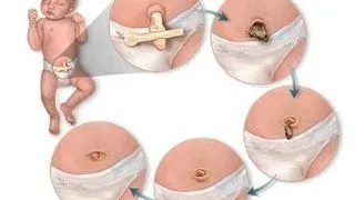 Tot ce trebuie s? ?tim despre cordonul ombilical