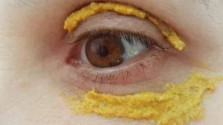 Aplica pasta de turmeric de jur imprejurul ochilor. Cateva minute mai tarziu...