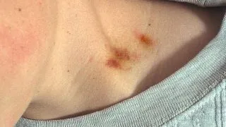 Vampir? A murit dupa ce iubita l-a sarutat pe gat!
