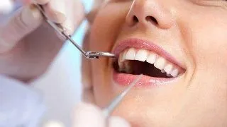 10 Motive care sustin optiunea de implant dentar. Cum se poate beneficia de un implant dentar ieftin?