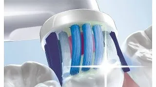 Avantajele unei periute electrice