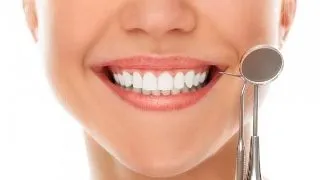 Cum sa previi aparitia tartrului dentar