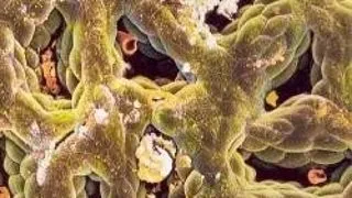 ANALIZA SUCULUI GASTRIC