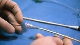 INFARCTUL MIOCARDIC