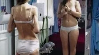 ANOREXIA SI ECSTASY