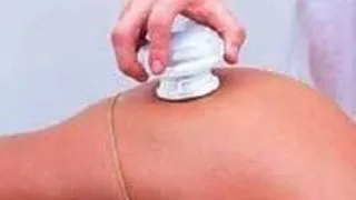 MEZOTERAPIA