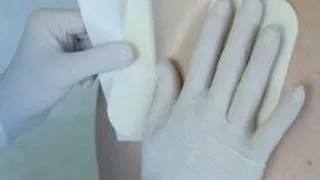 INFECTIILE PLAGILOR POSTOPERATORII. UTILITATEA PANSAMENTELOR.